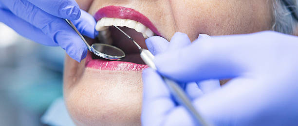 Best Emergency Treatment for Oral Infections in Altamonte Springs, FL